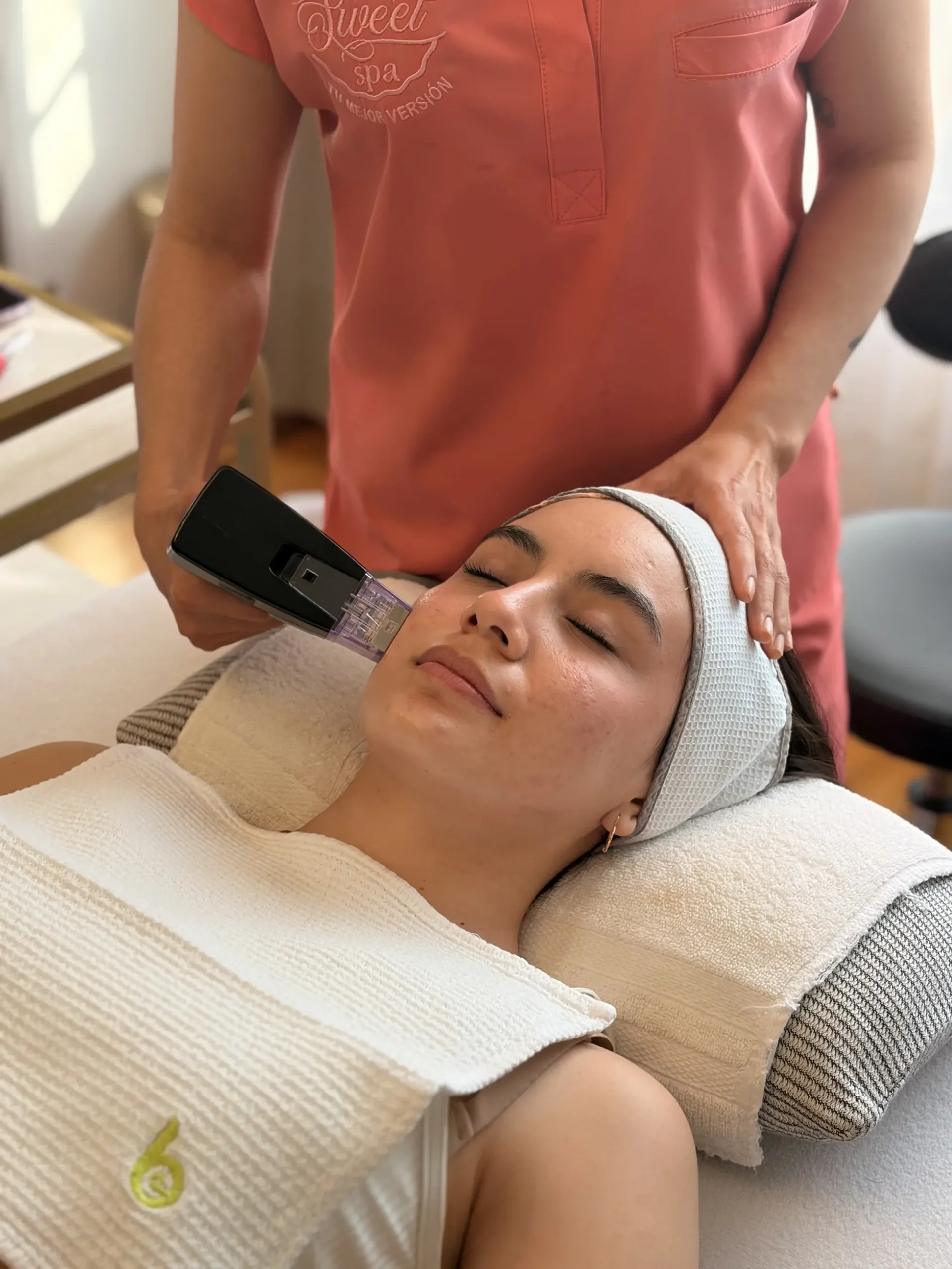 Resultados Morpheus 8 SweetSpa